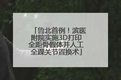 鲁北首例！滨医附院实施3D打印全距骨假体并人工全踝关节置换术